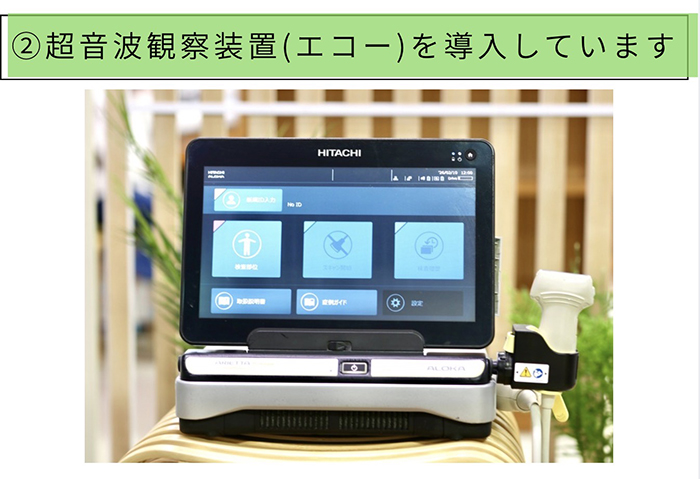超音波観察装置を導入しています